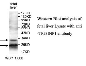 SIP / TP53INP1 Antibody