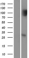SIP / TP53INP1 Protein - Western validation with an anti-DDK antibody * L: Control HEK293 lysate R: Over-expression lysate