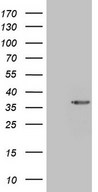 SIP1 Antibody - HEK293T cells were transfected with the pCMV6-ENTRY control. (Left lane) or pCMV6-ENTRY SIP1. (Right lane) cDNA for 48 hrs and lysed. Equivalent amounts of cell lysates. (5 ug per lane) were separated by SDS-PAGE and immunoblotted with anti-SIP1. (1:2000)