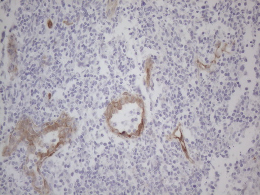 SIP1 Antibody - Immunohistochemical staining of paraffin-embedded Human tonsil within the normal limits using anti-GEMIN2 mouse monoclonal antibody. (Heat-induced epitope retrieval by 1mM EDTA in 10mM Tris buffer. (pH8.5) at 120°C for 3 min. (1:150)