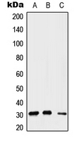 SIP1 Antibody - Western blot analysis of Gemin2 expression in A549 (A); Raw264.7 (B); H9C2 (C) whole cell lysates.