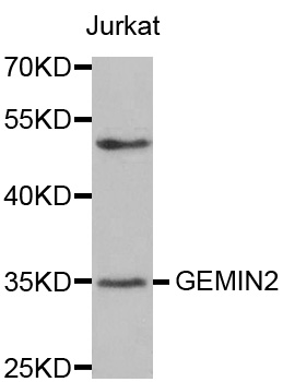 SIP1 Antibody - Western blot analysis of extracts of Jurkat cell line, using GEMIN2 antibody.