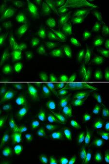 SIP1 Antibody - Immunofluorescence analysis of A549 cell using GEMIN2 antibody. Blue: DAPI for nuclear staining.