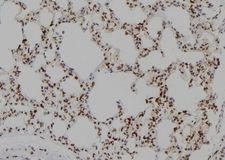 SIP1 Antibody - 1:100 staining rat lung tissue by IHC-P. The sample was formaldehyde fixed and a heat mediated antigen retrieval step in citrate buffer was performed. The sample was then blocked and incubated with the antibody for 1.5 hours at 22°C. An HRP conjugated goat anti-rabbit antibody was used as the secondary.