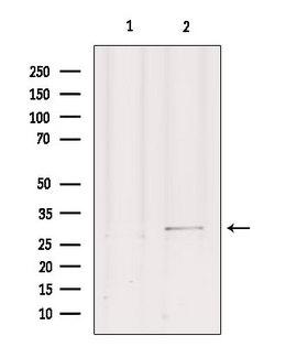 SIP1 Antibody - Western blot analysis of extracts of mouse brain tissue using GEMIN2 antibody. Lane 1 was treated with the blocking peptide.