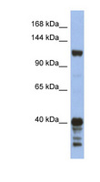 SIPA1 Antibody - SIPA1 antibody Western blot of HT1080 cell lysate. This image was taken for the unconjugated form of this product. Other forms have not been tested.