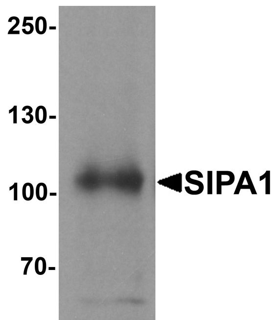 SIPA1 Antibody - Western blot analysis of SIPA1 in human brain tissue lysate with SIPA1 antibody at 1 ug/ml.