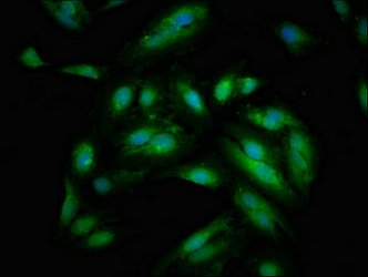SIPA1 Antibody - Immunofluorescent analysis of Hela cells at a dilution of 1:100 and Alexa Fluor 488-congugated AffiniPure Goat Anti-Rabbit IgG(H+L)