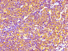 SIPA1 Antibody - Immunohistochemistry image of paraffin-embedded human lymph node tissue at a dilution of 1:100
