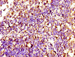 SIPA1 Antibody - Immunohistochemistry image of paraffin-embedded human tonsil tissue at a dilution of 1:100