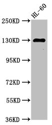 SIPA1 Antibody - Positive Western Blot detected in HL-60 whole cell lysate. All lanes: SIPA1 antibody at 2.7 µg/ml Secondary Goat polyclonal to rabbit IgG at 1/50000 dilution. Predicted band size: 112, 149 KDa. Observed band size: 130 KDa