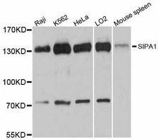 SIPA1 Antibody - Western blot analysis of extracts of various cell lines, using SIPA1 antibody at 1:3000 dilution. The secondary antibody used was an HRP Goat Anti-Rabbit IgG (H+L) at 1:10000 dilution. Lysates were loaded 25ug per lane and 3% nonfat dry milk in TBST was used for blocking. An ECL Kit was used for detection and the exposure time was 90s.