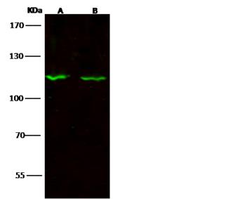 SIPA1 Antibody - Anti-SIPA1 rabbit polyclonal antibody at 1:500 dilution. Lane A: Hela Whole Cell Lysate. Lane B: NIH3T3 Whole Cell Lysate. Lysates/proteins at 30 ug per lane. Secondary: Goat Anti-Rabbit IgG H&L (Dylight 800) at 1/10000 dilution. Developed using the Odyssey technique. Performed under reducing conditions. Predicted band size: 112 kDa. Observed band size: 115 kDa.