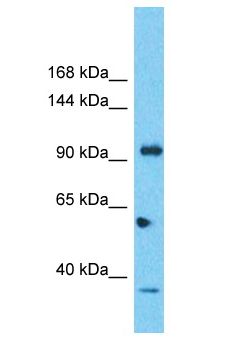 SIPA1L2 Antibody - SIPA1L2 antibody Western Blot of 721_B. Antibody dilution: 1 ug/ml.  This image was taken for the unconjugated form of this product. Other forms have not been tested.