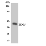 SIPR2 / S1P2 / EDG5 Antibody - Western blot analysis of the lysates from HT-29 cells using EDG5 antibody.