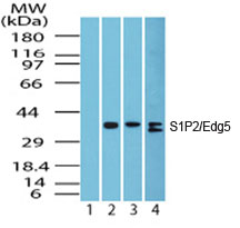 SIPR2 / S1P2 / EDG5 Antibody - Western blot analysis of S1P2/Edg5 in heart lysate; Lane 1 shows pre-immune sera; Lanes 2, 3 and 4 show Polyclonal Antibody to Edg5/S1P2 tested on human heart (1 ug/ml), mouse heart (1 ug/ml) and rat heart (2 ug/ml) lysate, respectively.