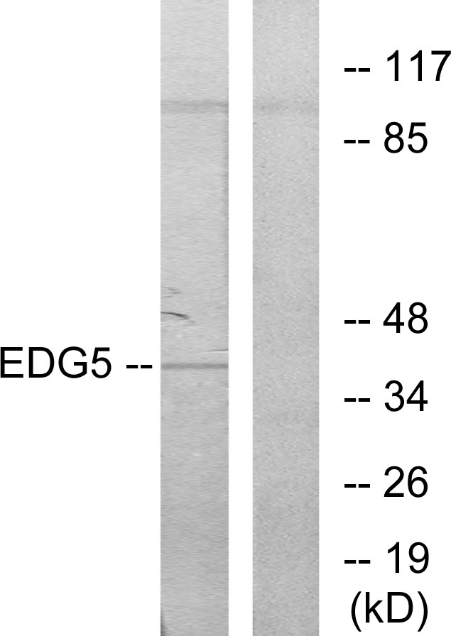 SIPR2 / S1P2 / EDG5 Antibody - Western blot analysis of lysates from COLO205 cells, using EDG5 Antibody. The lane on the right is blocked with the synthesized peptide.