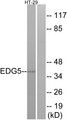 SIPR2 / S1P2 / EDG5 Antibody - Western blot analysis of lysates from HT-29 cells, using EDG5 Antibody. The lane on the right is blocked with the synthesized peptide.