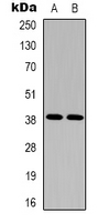 SIPR2 / S1P2 / EDG5 Antibody - Western blot analysis of EDG5 expression in HeLa (A); A10 (B) whole cell lysates.