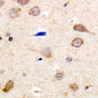 SIPR2 / S1P2 / EDG5 Antibody - Immunohistochemical analysis of EDG5 staining in human brain formalin fixed paraffin embedded tissue section. The section was pre-treated using heat mediated antigen retrieval with sodium citrate buffer (pH 6.0). The section was then incubated with the antibody at room temperature and detected with HRP and DAB as chromogen. The section was then counterstained with hematoxylin and mounted with DPX.