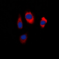 SIPR2 / S1P2 / EDG5 Antibody - Immunofluorescent analysis of EDG5 staining in HeLa cells. Formalin-fixed cells were permeabilized with 0.1% Triton X-100 in TBS for 5-10 minutes and blocked with 3% BSA-PBS for 30 minutes at room temperature. Cells were probed with the primary antibody in 3% BSA-PBS and incubated overnight at 4 deg C in a humidified chamber. Cells were washed with PBST and incubated with a DyLight 594-conjugated secondary antibody (red) in PBS at room temperature in the dark. DAPI was used to stain the cell nuclei (blue).