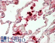 SIPR2 / S1P2 / EDG5 Antibody - Human Lung: Formalin-Fixed, Paraffin-Embedded (FFPE)