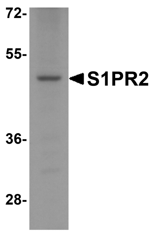 SIPR2 / S1P2 / EDG5 Antibody - Western blot analysis of S1PR2 in HeLa cell lysate with S1PR2 antibody at 1 ug/ml.