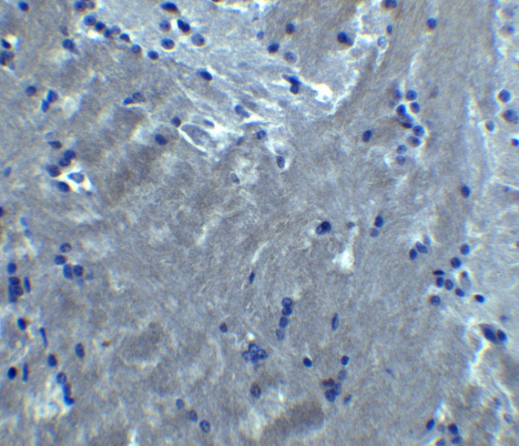 SIPR2 / S1P2 / EDG5 Antibody - Immunohistochemistry of S1PR2 in mouse brain tissue with S1PR2 antibody at 10 ug/ml.