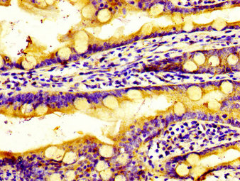 SIPR2 / S1P2 / EDG5 Antibody - Immunohistochemistry image of paraffin-embedded human small intestine tissue at a dilution of 1:100