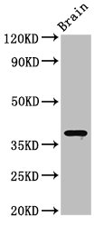 SIPR2 / S1P2 / EDG5 Antibody - Positive Western Blot detected in Mouse brain tissue. All lanes: S1PR2 antibody at 3 µg/ml Secondary Goat polyclonal to rabbit IgG at 1/50000 dilution. Predicted band size: 39 KDa. Observed band size: 39 KDa