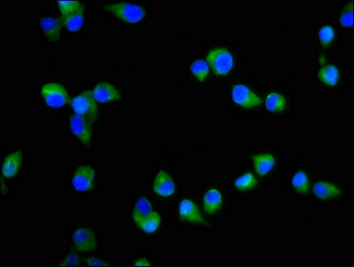 SIPR2 / S1P2 / EDG5 Antibody - Immunofluorescence staining of SH-SY5Y cells with S1PR2 Antibody at 1:200, counter-stained with DAPI. The cells were fixed in 4% formaldehyde, permeabilized using 0.2% Triton X-100 and blocked in 10% normal Goat Serum. The cells were then incubated with the antibody overnight at 4°C. The secondary antibody was Alexa Fluor 488-congugated AffiniPure Goat Anti-Rabbit IgG(H+L).