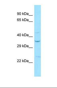 SIPR2 / S1P2 / EDG5 Antibody - Western blot of Human COLO205. S1PR2 antibody dilution 1.0 ug/ml.