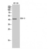SIPR3 / EDG3 / S1P3 Antibody - Western blot of EDG-3 antibody