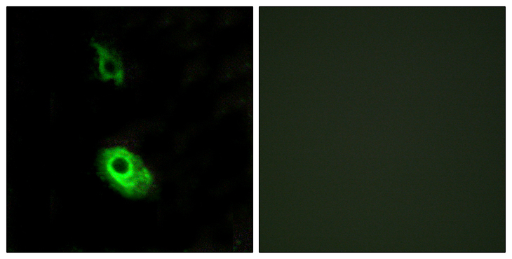 SIPR3 / EDG3 / S1P3 Antibody - Immunofluorescence analysis of HeLa cells, using EDG3 Antibody. The picture on the right is blocked with the synthesized peptide.