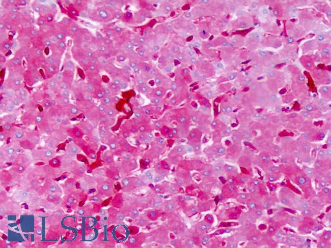 SIPR3 / EDG3 / S1P3 Antibody - Anti-EDG3 / S1P3 antibody IHC of human liver. Immunohistochemistry of formalin-fixed, paraffin-embedded tissue after heat-induced antigen retrieval. Antibody dilution 5-10 ug/ml. This image was taken for the unconjugated form of this product. Other forms have not been tested.