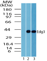 SIPR3 / EDG3 / S1P3 Antibody - Western blot of Sphingolipid Receptor Edg3/S1P3 in kidney lysate. Lane 1 shows pre-immune sera. Lanes 2 and 3 show Polyclonal Antibody to Sphingolipid Receptor Edg3/S1P3 tested on human kidney (2 ug/ml) and mouse kidney (1 ug/ml) lysate. Goat anti-rabbit Ig HRP secondary antibody, and PicoTect ECL substrate solution, were used for this test.