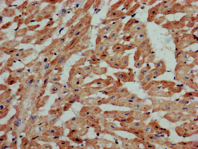 SIPR3 / EDG3 / S1P3 Antibody - IHC image of S1PR3 Antibody diluted at 1:800 and staining in paraffin-embedded human heart tissue performed on a Leica BondTM system. After dewaxing and hydration, antigen retrieval was mediated by high pressure in a citrate buffer (pH 6.0). Section was blocked with 10% normal goat serum 30min at RT. Then primary antibody (1% BSA) was incubated at 4°C overnight. The primary is detected by a biotinylated secondary antibody and visualized using an HRP conjugated SP system.