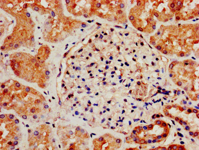 SIPR3 / EDG3 / S1P3 Antibody - IHC image of S1PR3 Antibody diluted at 1:800 and staining in paraffin-embedded human kidney tissue performed on a Leica BondTM system. After dewaxing and hydration, antigen retrieval was mediated by high pressure in a citrate buffer (pH 6.0). Section was blocked with 10% normal goat serum 30min at RT. Then primary antibody (1% BSA) was incubated at 4°C overnight. The primary is detected by a biotinylated secondary antibody and visualized using an HRP conjugated SP system.