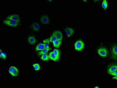 SIPR3 / EDG3 / S1P3 Antibody - Immunofluorescent analysis of MCF-7 cells using S1PR3 Antibody at dilution of 1:100 and Alexa Fluor 488-congugated AffiniPure Goat Anti-Rabbit IgG(H+L)