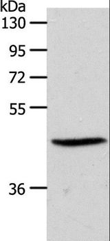 SIPR3 / EDG3 / S1P3 Antibody - Western blot analysis of PC3 cell, using S1PR3 Polyclonal Antibody at dilution of 1:550.