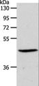 SIPR3 / EDG3 / S1P3 Antibody - Western blot analysis of PC3 cell, using S1PR3 Polyclonal Antibody at dilution of 1:550.