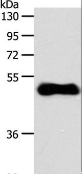 SIPR3 / EDG3 / S1P3 Antibody - Western blot analysis of Human fetal brain tissue, using S1PR3 Polyclonal Antibody at dilution of 1:700.