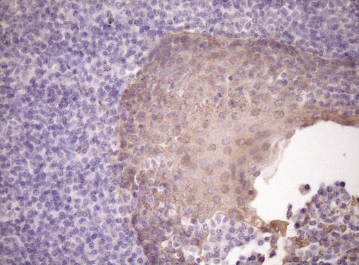 SIRPA / CD172a Antibody - IHC of paraffin-embedded Human tonsil using anti-SIRPA mouse monoclonal antibody. (Heat-induced epitope retrieval by Tris-EDTA, pH8.0)(1:150).