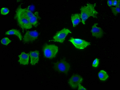 SIRPA / CD172a Antibody - Immunofluorescence staining of MCF-7 cells diluted at 1:133, counter-stained with DAPI. The cells were fixed in 4% formaldehyde, permeabilized using 0.2% Triton X-100 and blocked in 10% normal Goat Serum. The cells were then incubated with the antibody overnight at 4°C.The Secondary antibody was Alexa Fluor 488-congugated AffiniPure Goat Anti-Rabbit IgG (H+L).