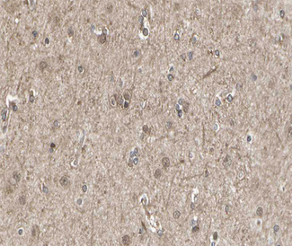 SIRPA / CD172a Antibody - 1:100 staining human brain tissue by IHC-P. The tissue was formaldehyde fixed and a heat mediated antigen retrieval step in citrate buffer was performed. The tissue was then blocked and incubated with the antibody for 1.5 hours at 22°C. An HRP conjugated goat anti-rabbit antibody was used as the secondary.