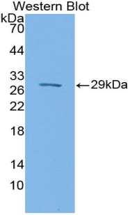 SIRPB1 / CD172b Antibody - Western blot of recombinant SIRPB1 / CD172b.