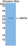 SIRPB1 / CD172b Antibody - Western blot of recombinant SIRPB1 / CD172b.