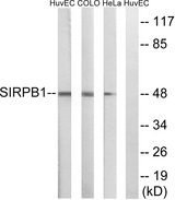 SIRPB1 / CD172b Antibody - Western blot analysis of lysates from HeLa, COLO, and HUVEC cells, using SIRPB1 Antibody. The lane on the right is blocked with the synthesized peptide.