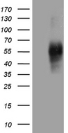 SIRPB1 / CD172b Antibody - HEK293T cells were transfected with the pCMV6-ENTRY control. (Left lane) or pCMV6-ENTRY SIRPB1. (Right lane) cDNA for 48 hrs and lysed. Equivalent amounts of cell lysates. (5 ug per lane) were separated by SDS-PAGE and immunoblotted with anti-SIRPB1. (1:2000)