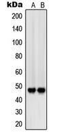 SIRPB1 / CD172b Antibody - Western blot analysis of CD172b expression in A375 (A); A549 (B) whole cell lysates.